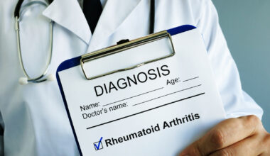 Die Rolle des Rheumatologen